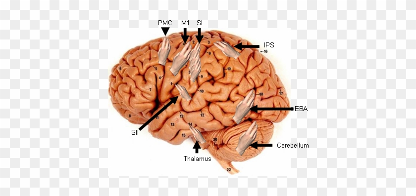 Indeed, We Know Of Multiple Representations Of The - Como Afecta La Fiebre Reumatica En El Cerebro #542338