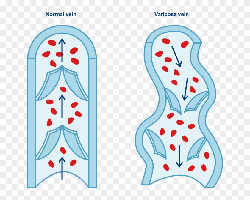 Comparaison Comparaison - Simile #585598