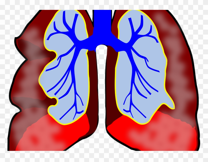 How To Become A Respiratory Therapist For Air Ambulances - Differences Between An Inspiratory And Expiratory Wheeze #614610