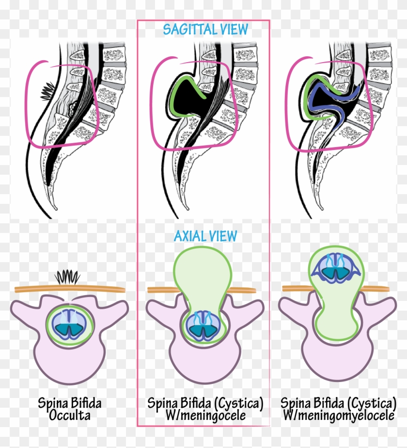 Neuroanatomy Glossary - Graphics #619729