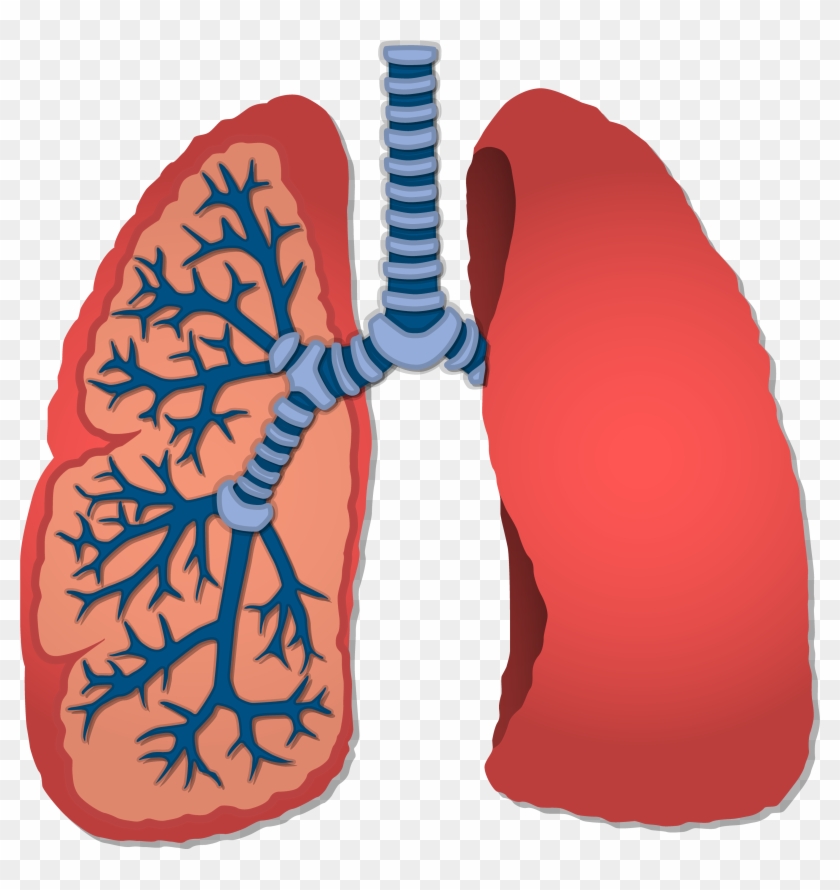 Pulmonary Pleurae Lung Tuberculosis Pleural Cavity - Pulmonary Pleurae Lung Tuberculosis Pleural Cavity #696230