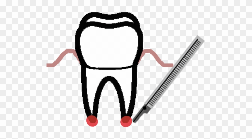 Dentoalveolar Surgery - Sketch #767061