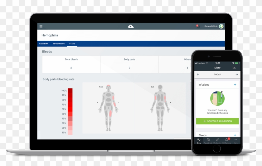 Medtep Hemophilia - Haemophilia #1116821