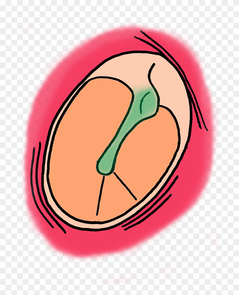 Grommet Anatomy - Grommet Anatomy #1198169