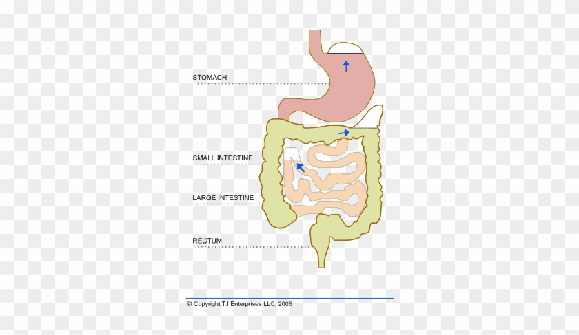 Trapped Gas Causes Blockages And Bloating In The Intestines - Flatulence #1310167