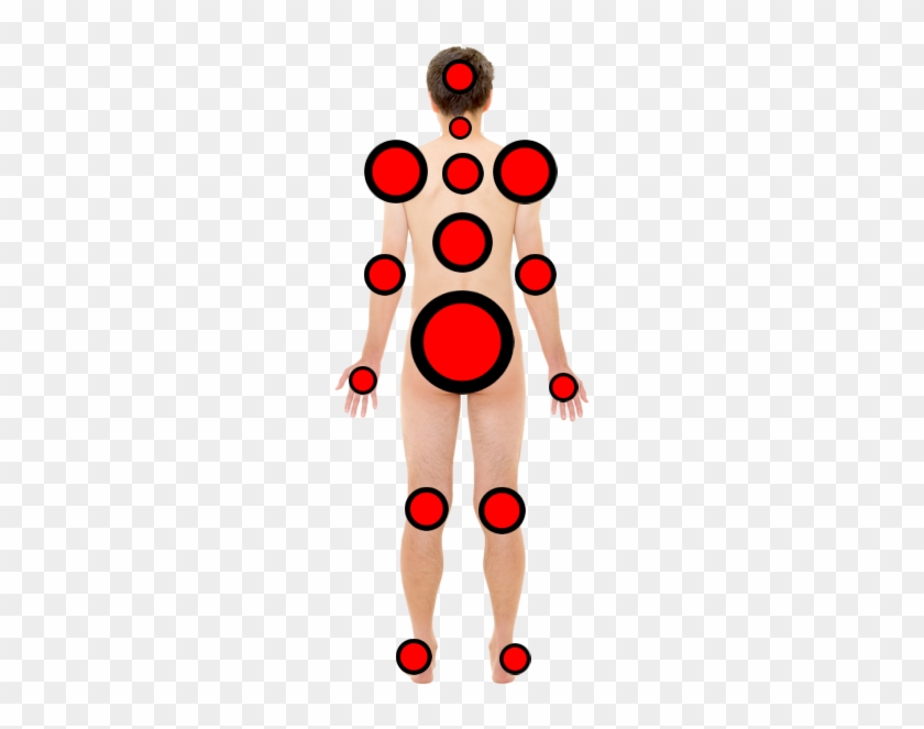 Systemic Disease - Systemic Disease #1394019