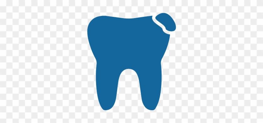 Tooth Colored Fillings - Tooth Colored Fillings #1399448