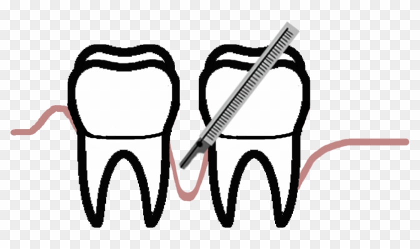 Periodontal Disease Is The Second Largest Cause Of - Periodontology #1434983