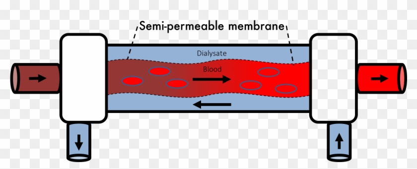 High Efficiency - Low Flux Dialyzers #1437806