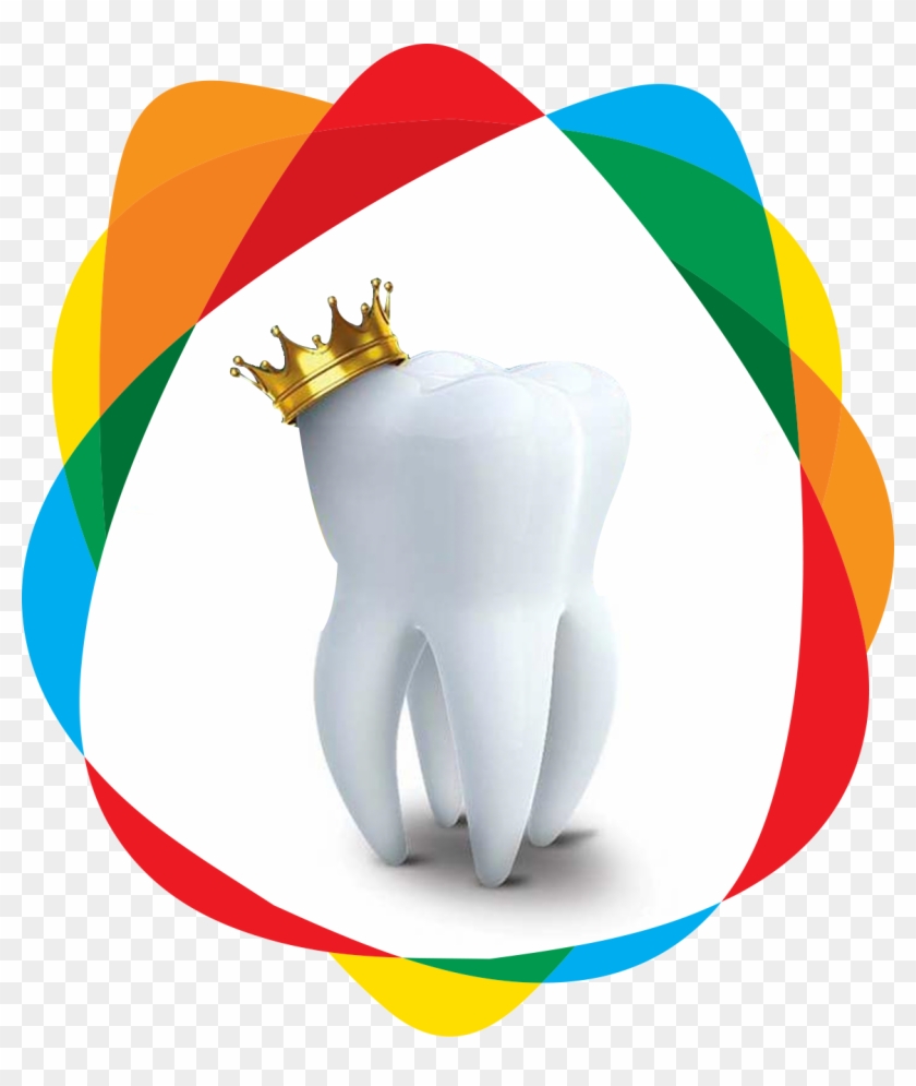 Crowns Ideal Smile Crown - Crowns Ideal Smile Crown #1480557