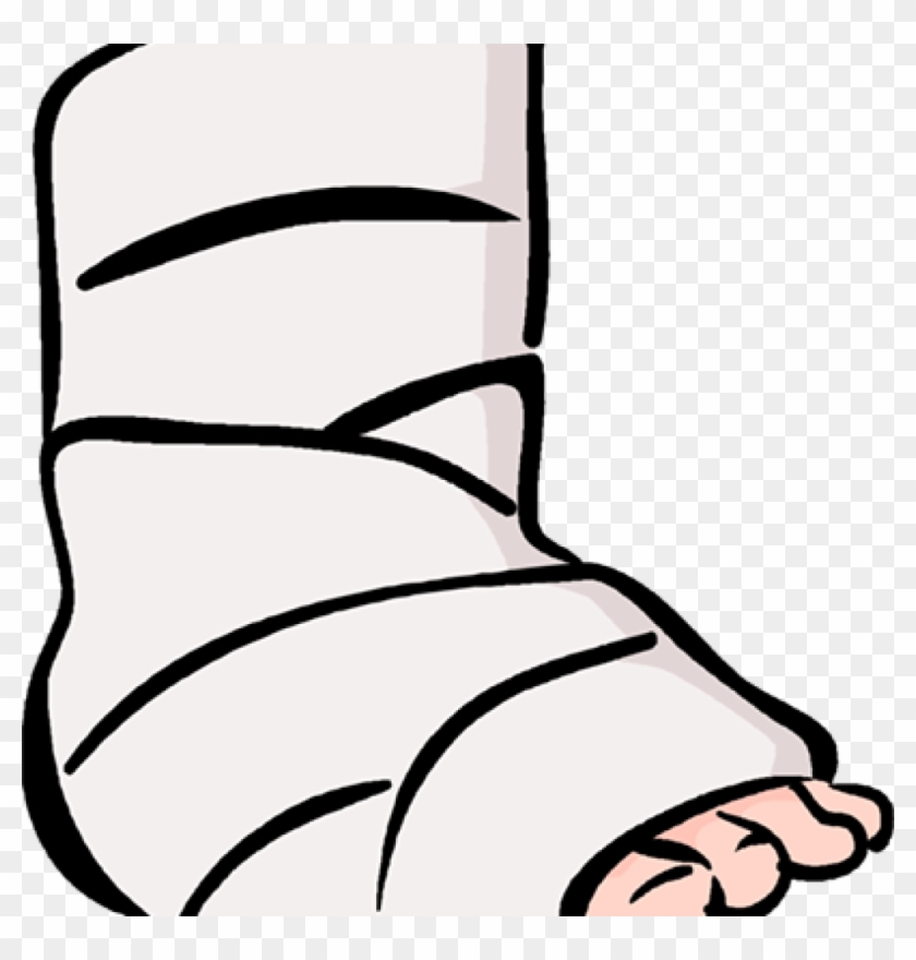 Broken Clip Art 15 Broken Clipart Broken Ankle For - Broken Clip Art 15 Broken Clipart Broken Ankle For #1481093