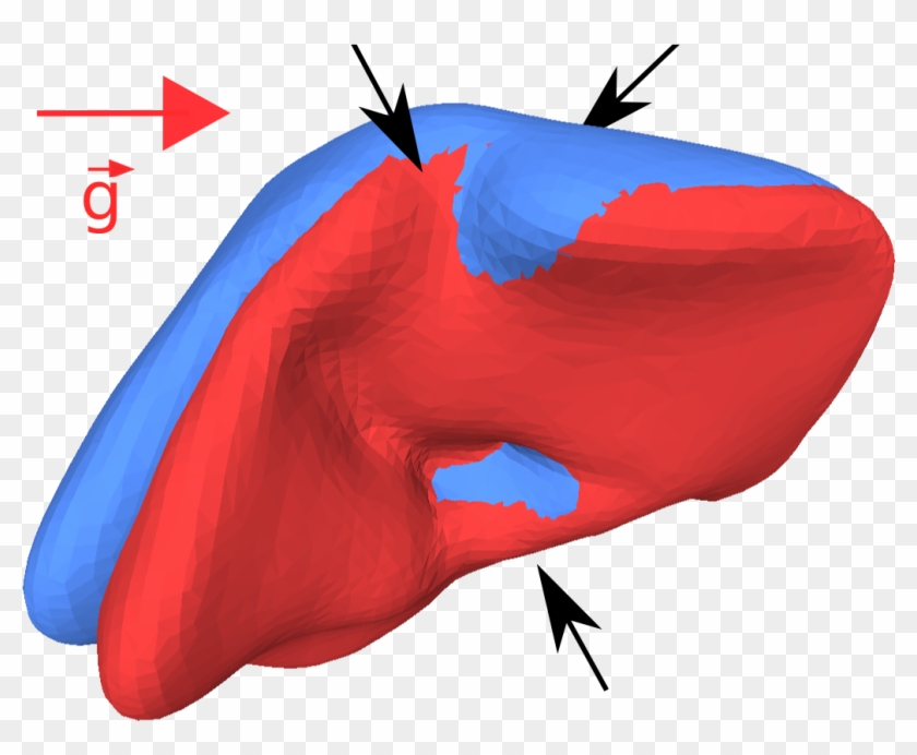 Atlas-based Transfer Of Boundary Conditions For Biomechanical - Atlas-based Transfer Of Boundary Conditions For Biomechanical #1531637