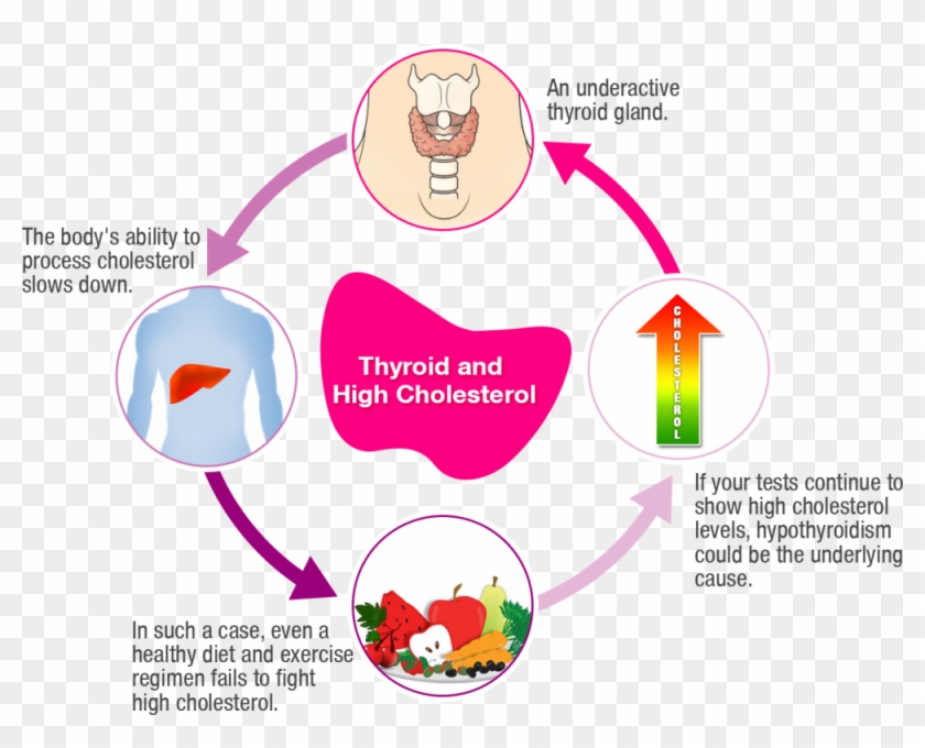 Thyroid Disorder And High Cholesterol - Thyroid Disorder And High Cholesterol #1544727