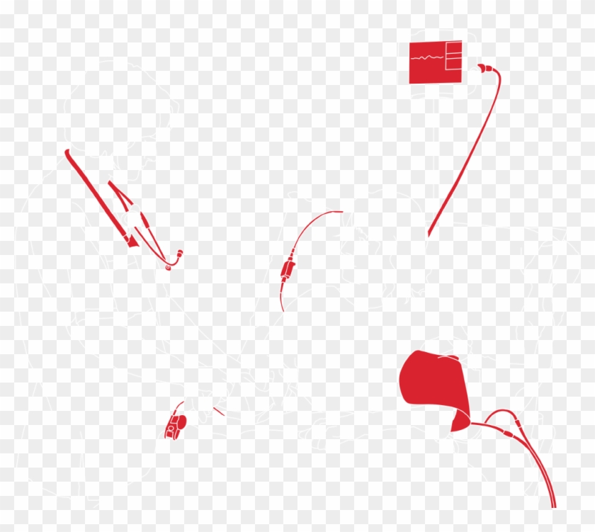 Earlier Detection Of Sepsis - Diagram #1740674