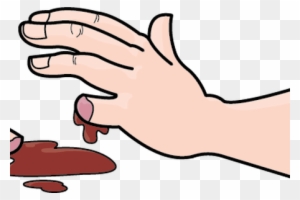 Wound Clipart Bleeding Kansas - Amputation Finger Clipart - Free ...